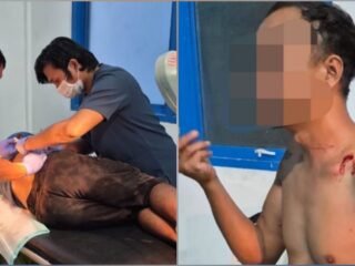 Aksi Kekerasan di Jalan Warabuke Kobakma, Polisi Masih Memburu Pelaku